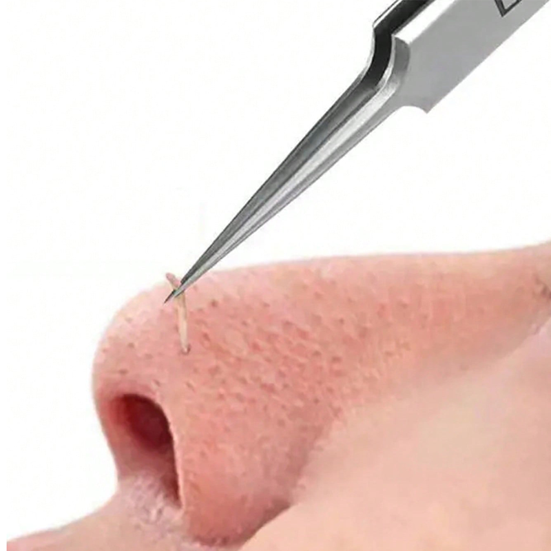 4/6PCS Face Cleaning Kit Pimpl - Luxury Skincare Acne 评论和价格