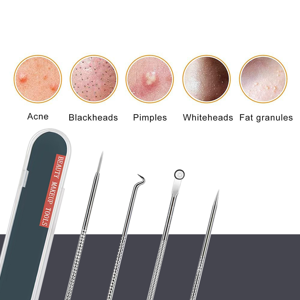 Pimple Popper Tool Kit Blackhe - Luxury Skincare Acne 评论和价格