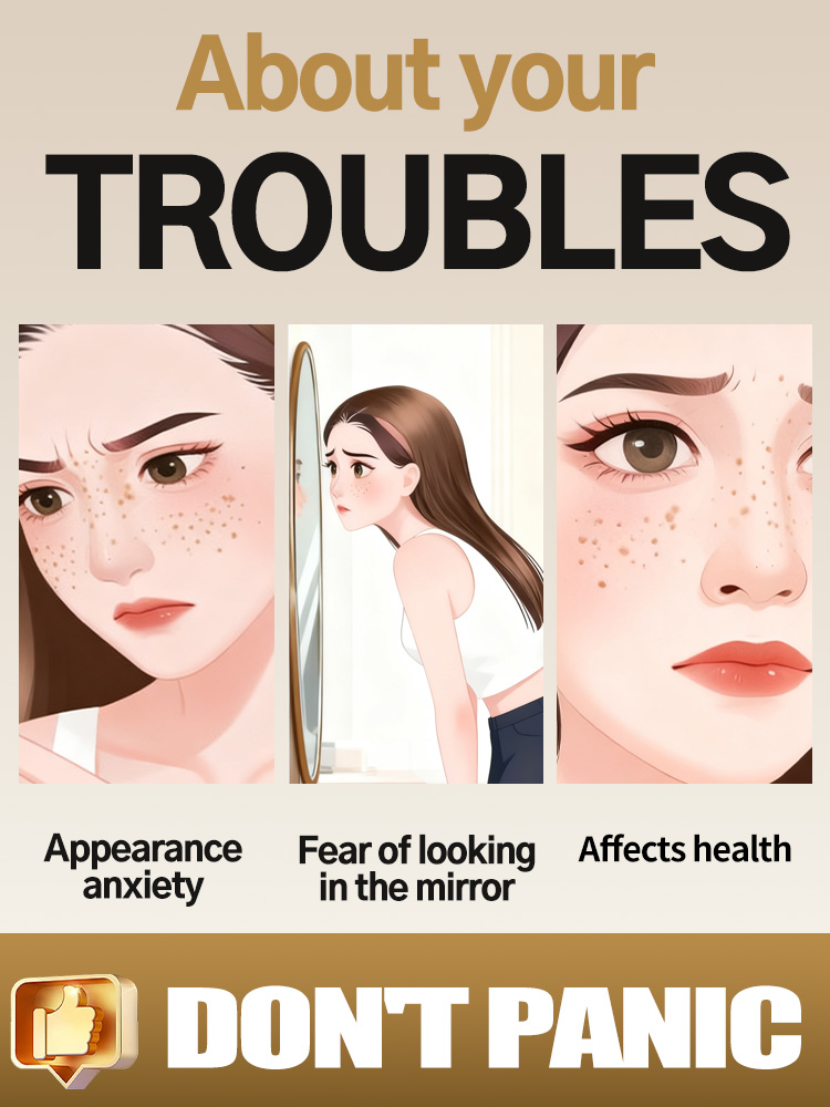 Lightening Facial Freckles Mel - Skincare Luxury Whitening 评论和价格