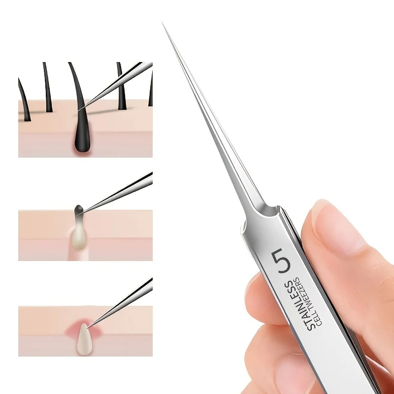 Higt Quality Acne Blackhead Re - Luxury Skincare Acne 评论和价格