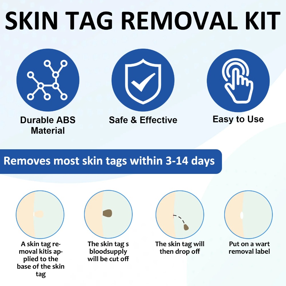 2-IN-1 Auto Skin Tag Removal T - Luxury Skincare Acne 评论和价格