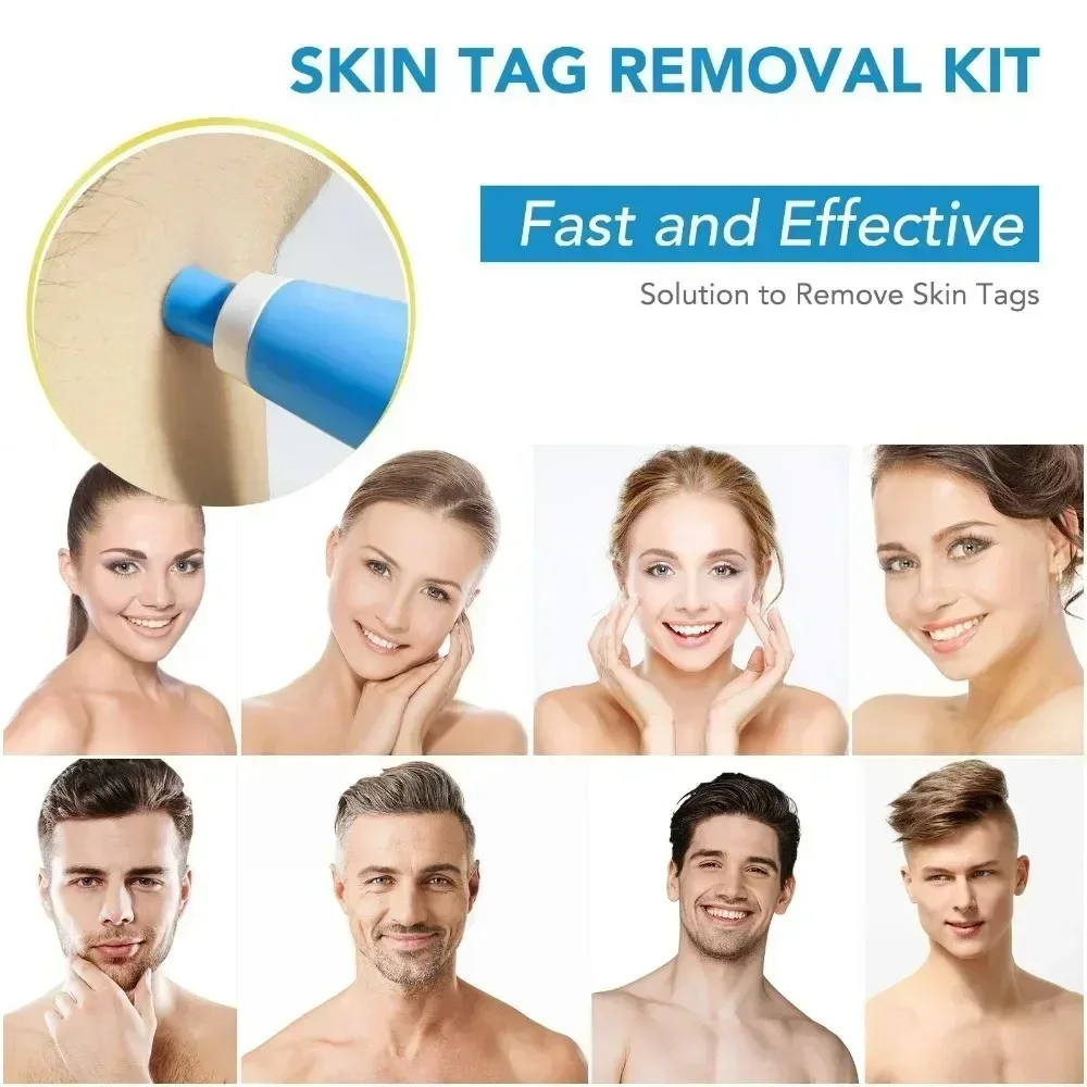 Acne Remover 2 IN 1 Auto Micro - Luxury Skincare Acne 评论和价格