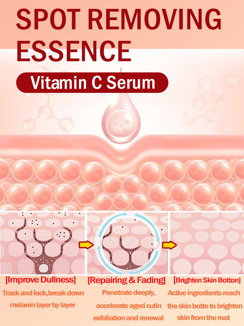 Lighten Freckles Melasma, Faci - Skincare Luxury Whitening 评论和价格