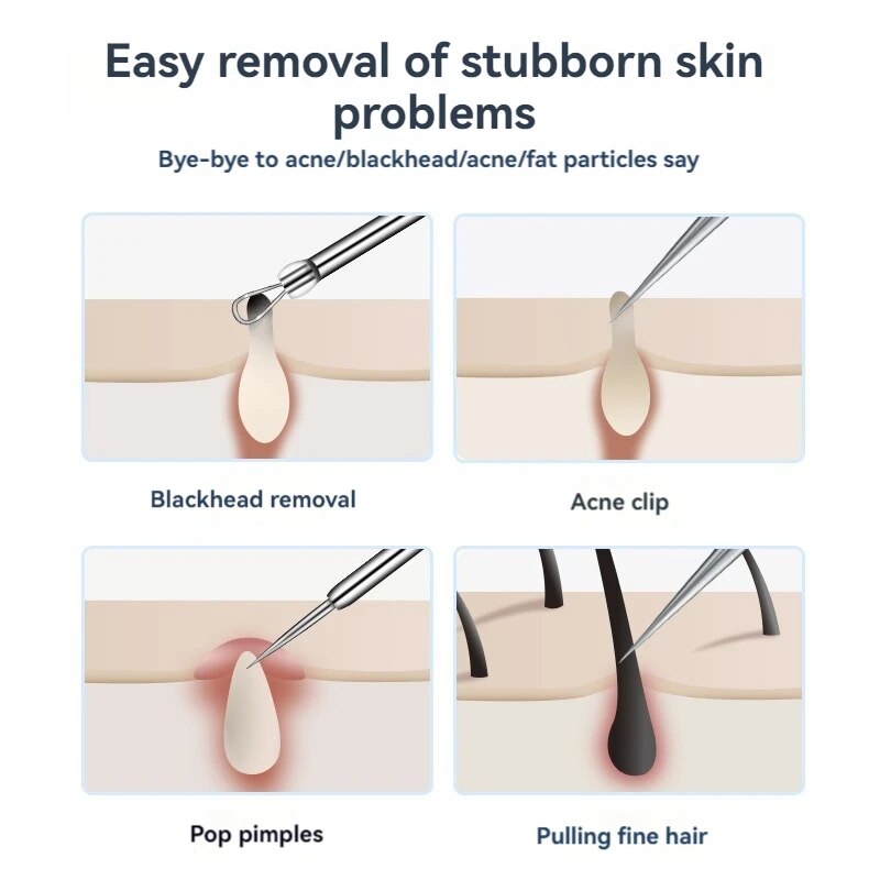 7pcs Stainless Steel Splinter  - Luxury Skincare Acne 评论和价格